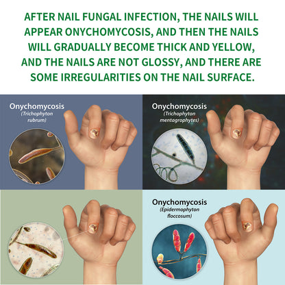 Jaysuing Ginger Nail Care Solution Repair Nails Soft Nail Shine Moisturizing Solution Gray Nails